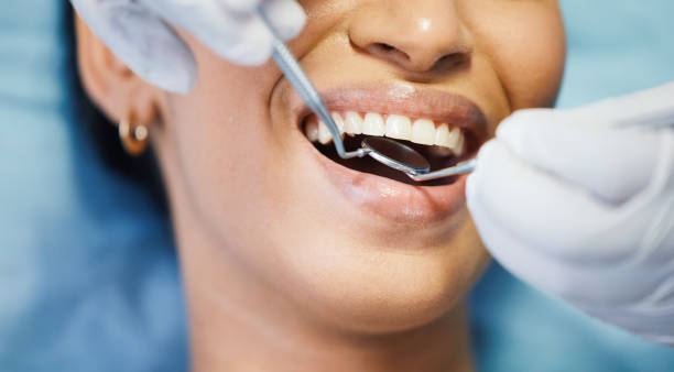 Best Urgent Care for Lost Fillings or Crowns in Lake Park, GA