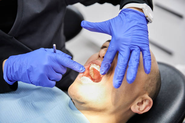Best Emergency Wisdom Teeth Removal in Lake Park, GA